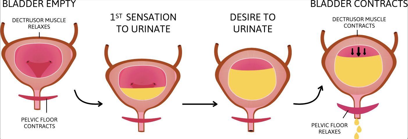 Bladder Pain Syndrome / Interstitial Cystitis – BIEN Australia