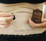 BIEN Scar and Skin Oil