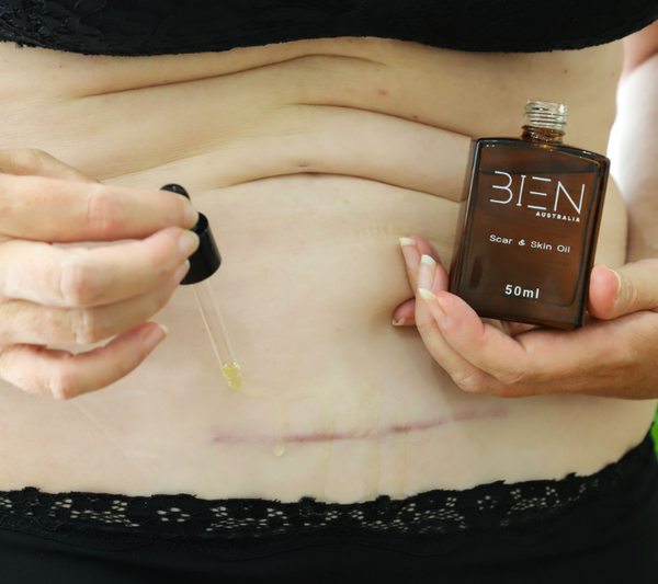 BIEN Scar and Skin Oil